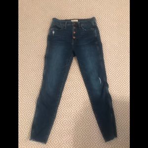 Madewell button fly skinny jeans